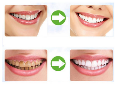 BUY 1 GET 2 FREE TEETH WHITENING PEN