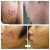 NATURAL STRETCH MARKS AND SCAR REMOVAL GEL